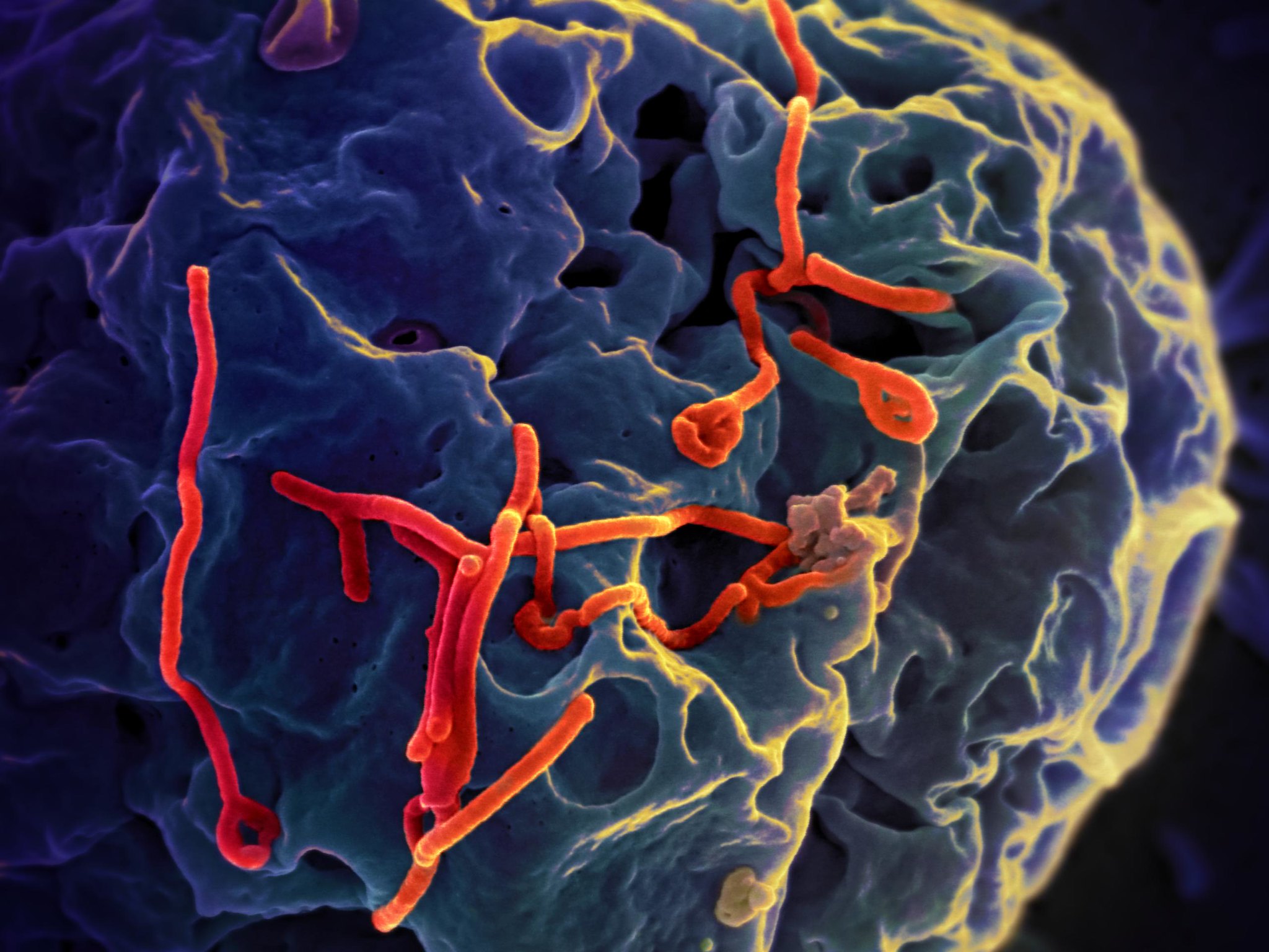 Ebola Virus Disease