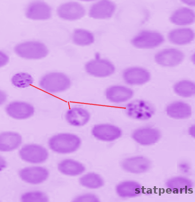 <p>Reticulocytes.</p>