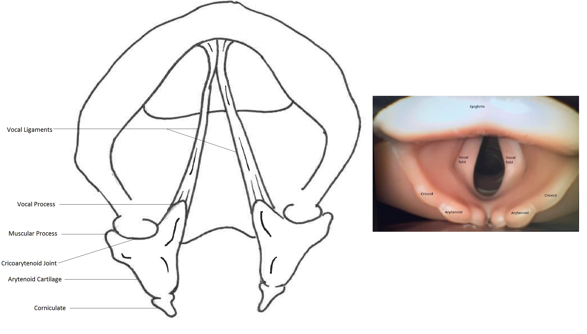 <p>Anatomy of the Laryngeal Cartilages and Vocal Folds