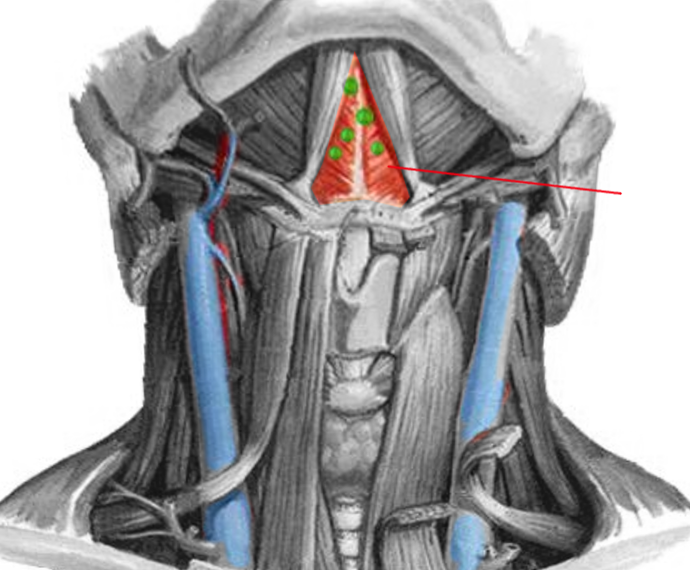 <p>Submental Triangle.</p>