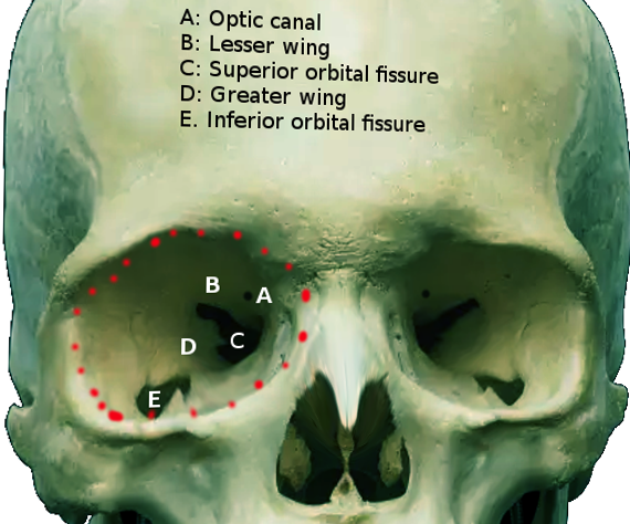 <p>Optic Canal, Labeled.</p>