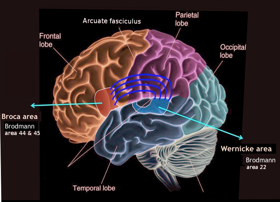 <p>The Broca and Wernicke Areas of the Brain