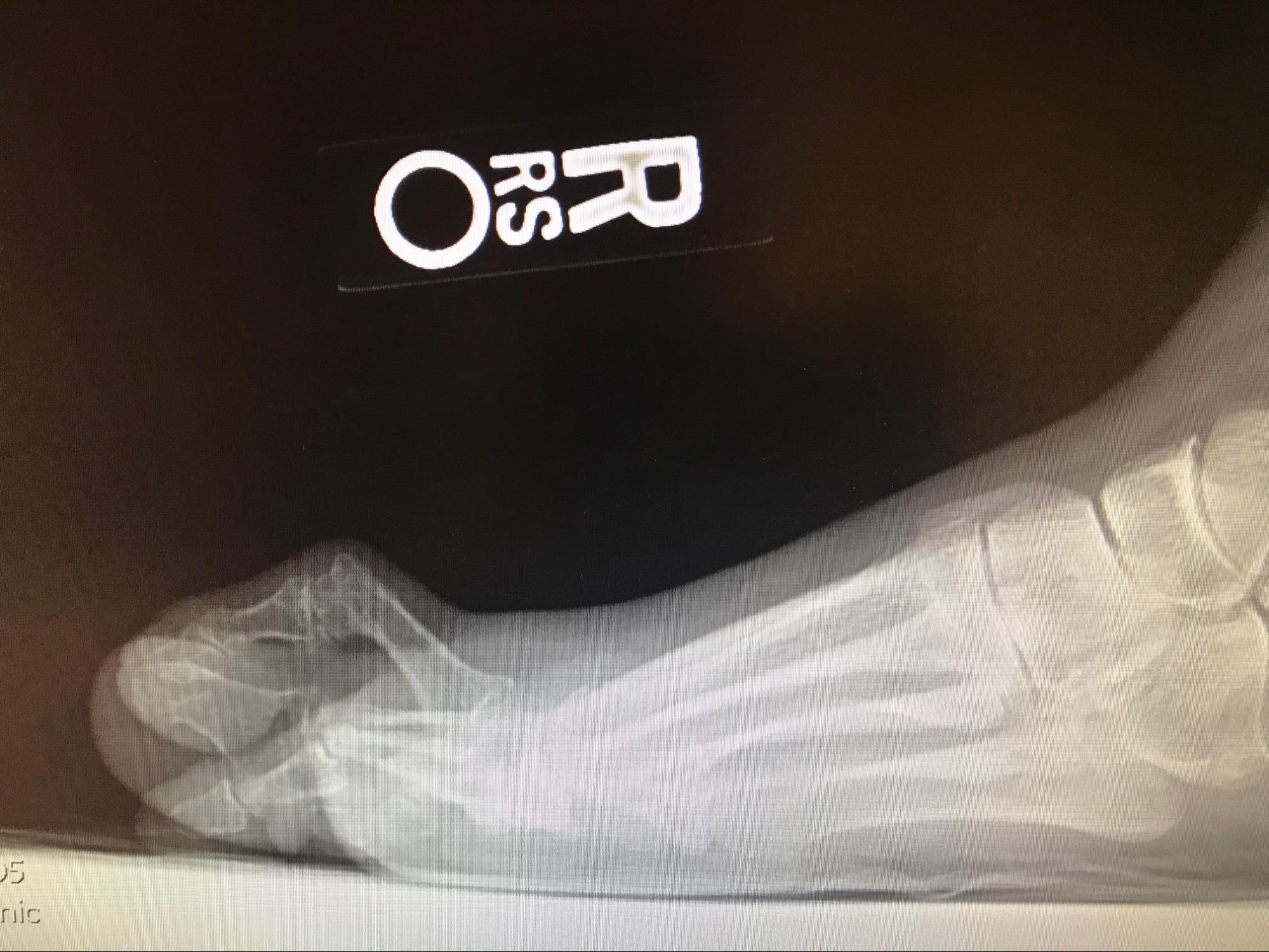 <p>Radiographic Studies