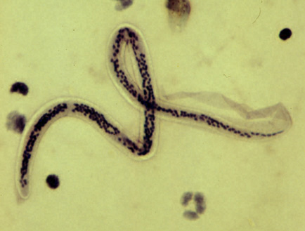 <p><em>Wuchereria bancrofti.</em></p>