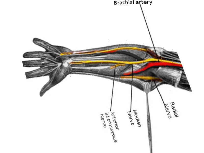 <p>Course&nbsp;of the Median Nerve in the Forearm