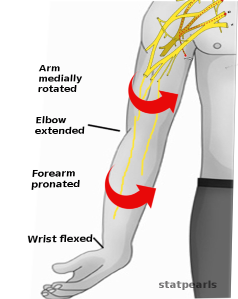 <p>Erb Palsy Physical Examination