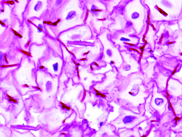 <p><em>Candida albicans.</em></p>