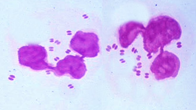 <p><em>N Gonorrhoeae.</em> Image of <em>N gonorrhoeae</em>; note diplococci.</p>