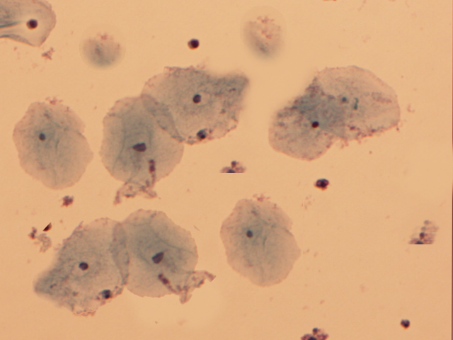 <p>Clue Cells
