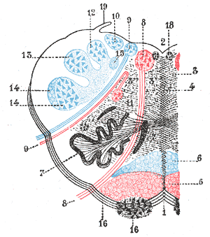 <p>Lateral Medullary Syndrome