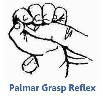 <p>Palmar Reflex