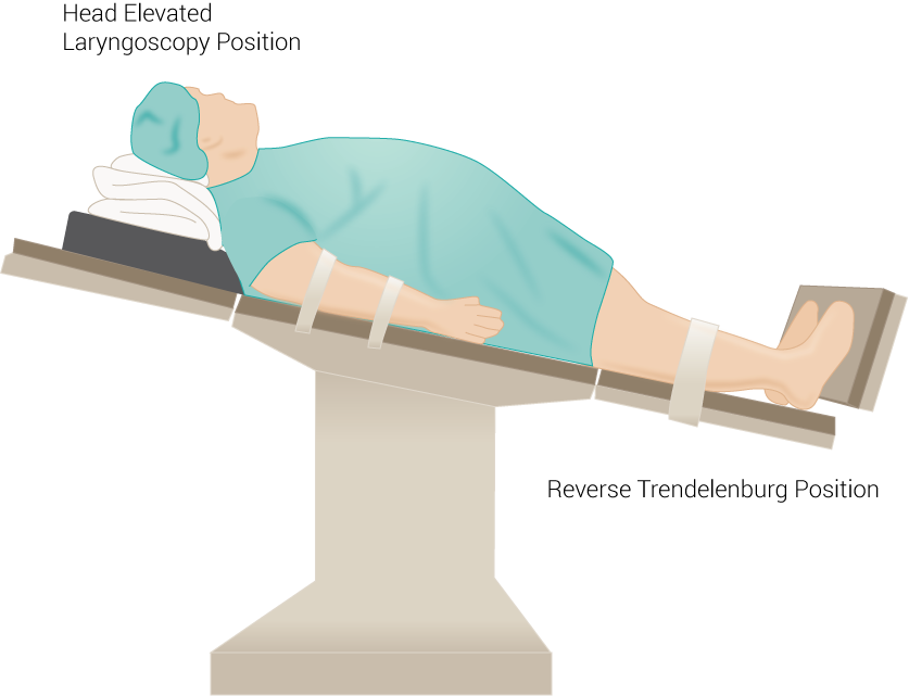 <p>Reverse Trendelenberg or Laryngoscopy Position.</p>