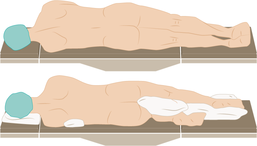 <p>Lateral Decubitus Position.</p>