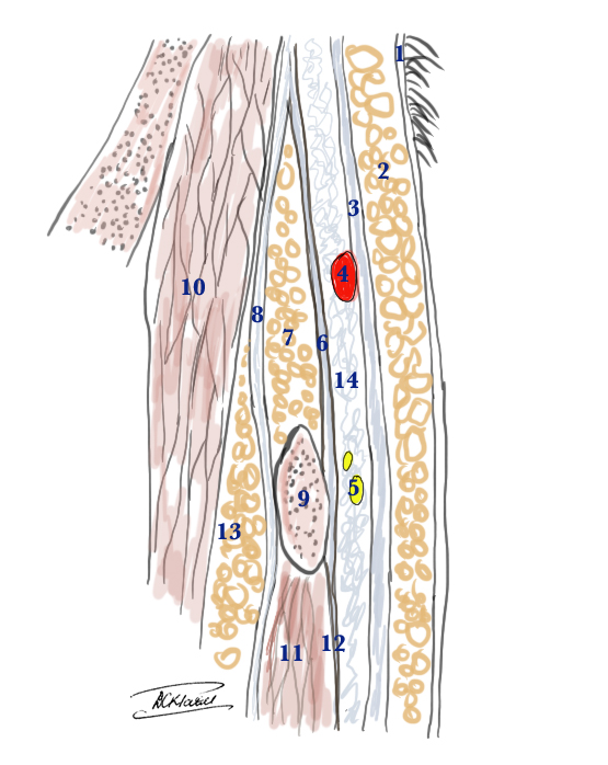 <p>Superficial Temporal Artery and Temporal Branch of the Facial Nerve