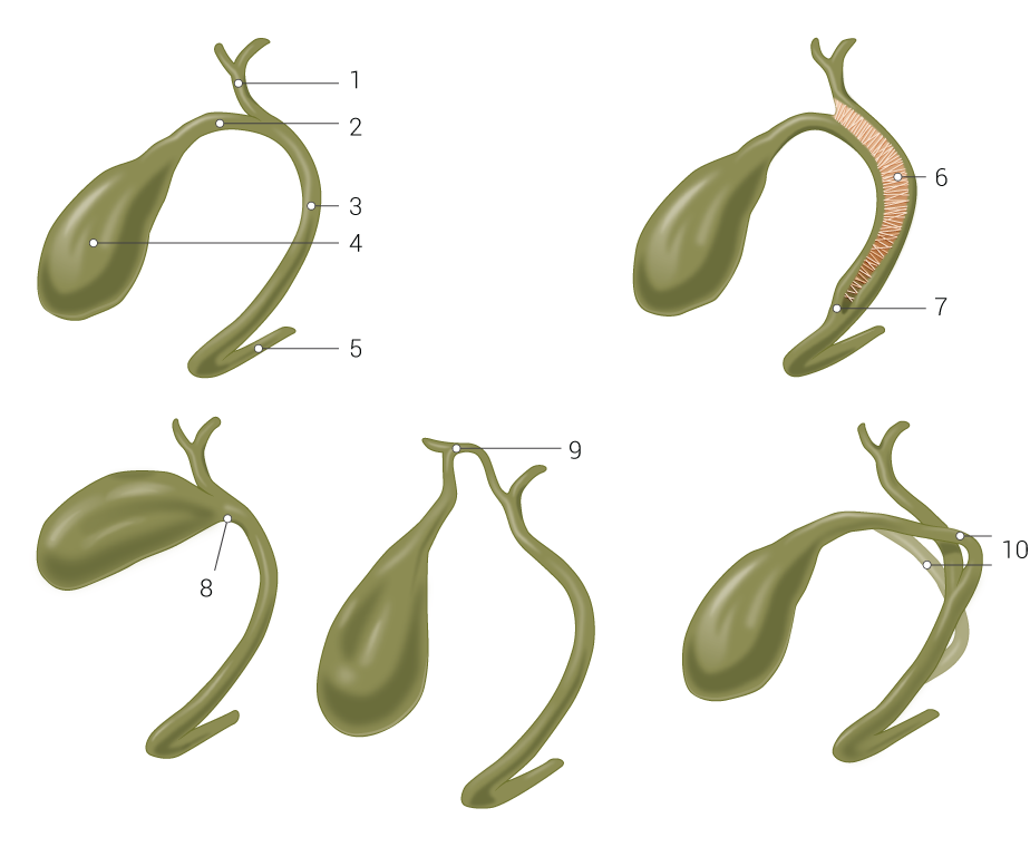 <p>Anatomical Variants of the Gallbladder and Biliary Tree