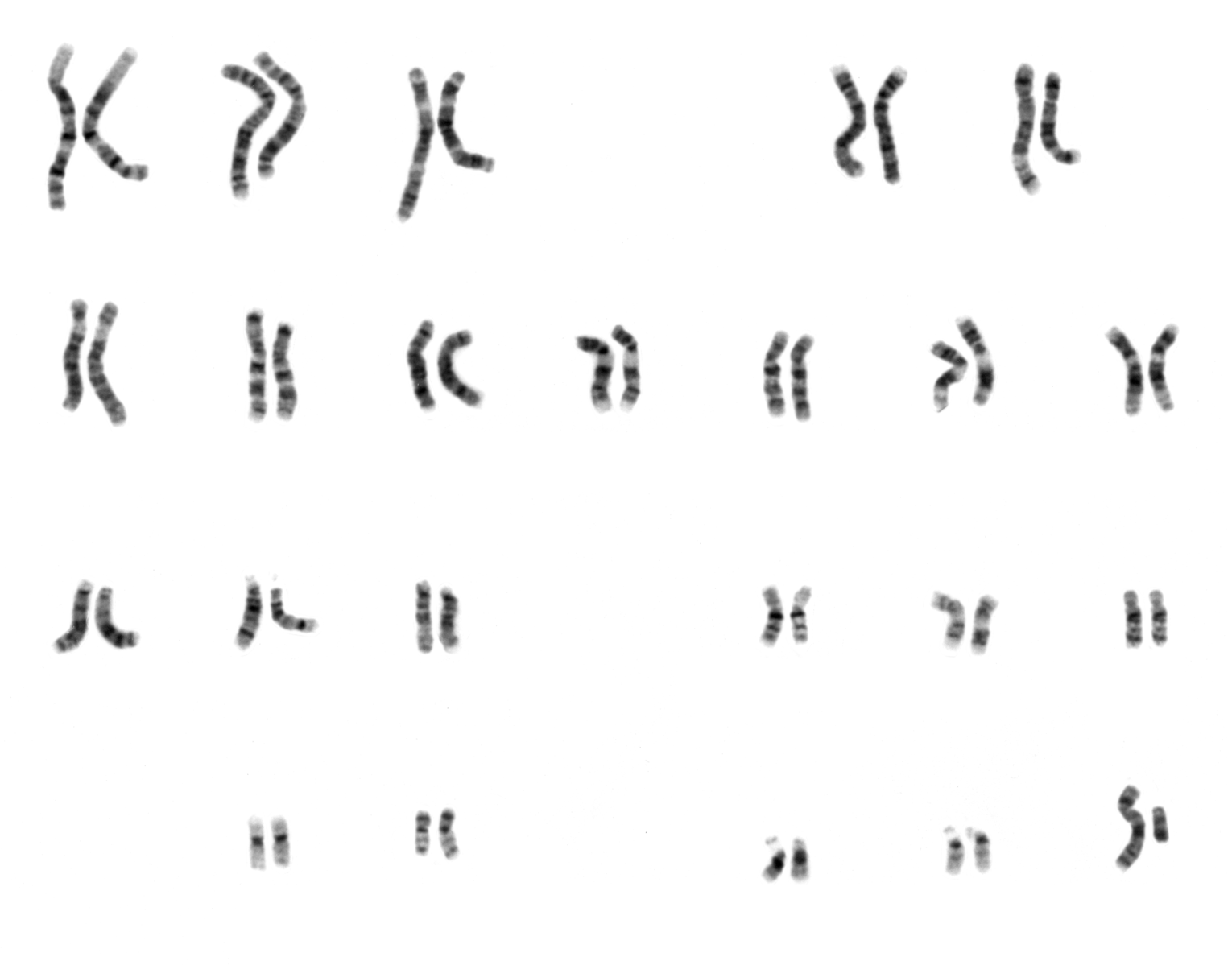 <p>Human Male Karyotype. The male karyotype has 22 pairs of autosomes and a pair of sex chromosomes (XY).</p>
