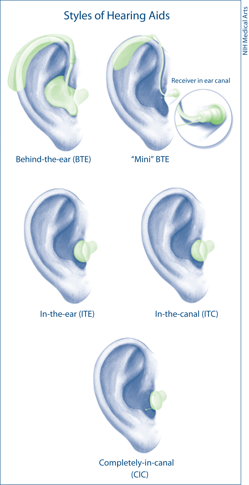 <p>Styles of Hearing Aids