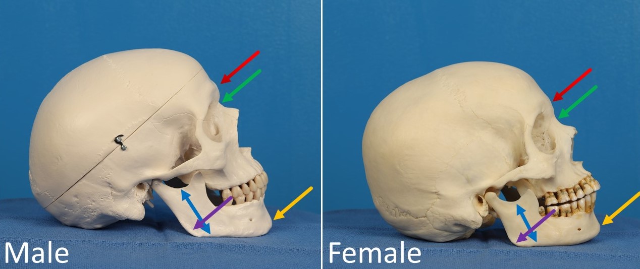<p>Differences Between Male and Female Skulls