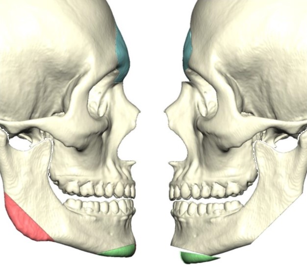 <p>Surgical Simulation