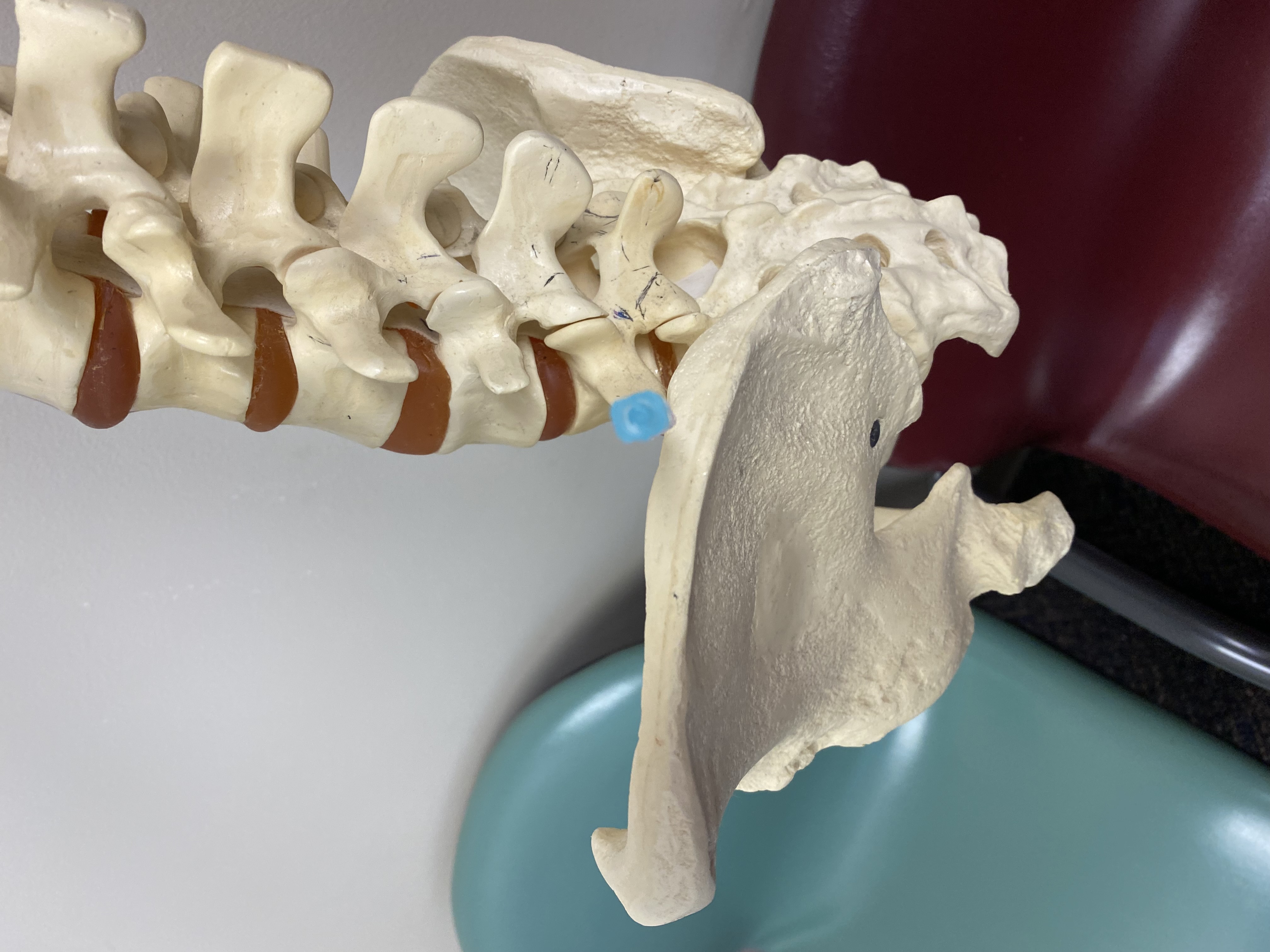 <p>Iliac Crest Modifications