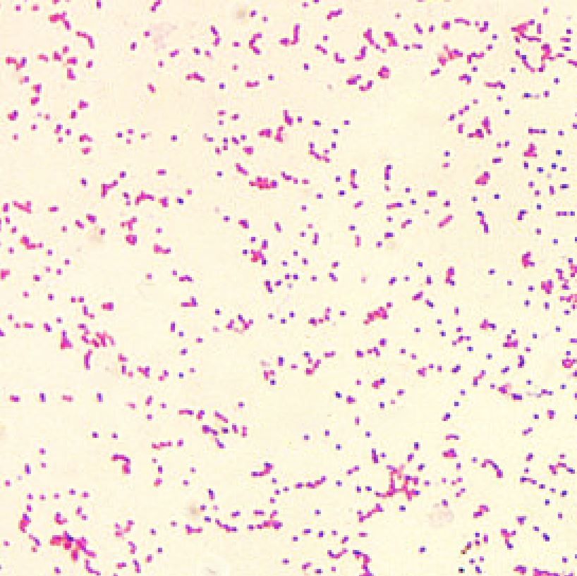 <p>Gram stain showing brucella, a gram-negative bacteria. They are small single cells that are poorly stained.</p>