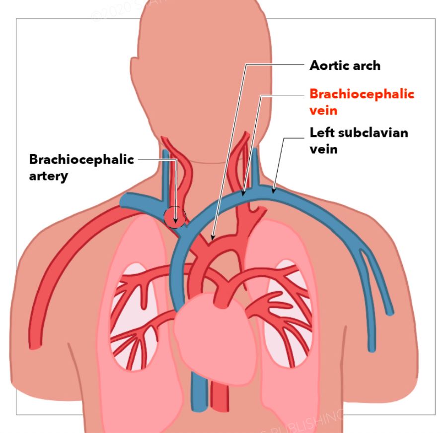 <p>Vascular Structures of the Upper Thorax