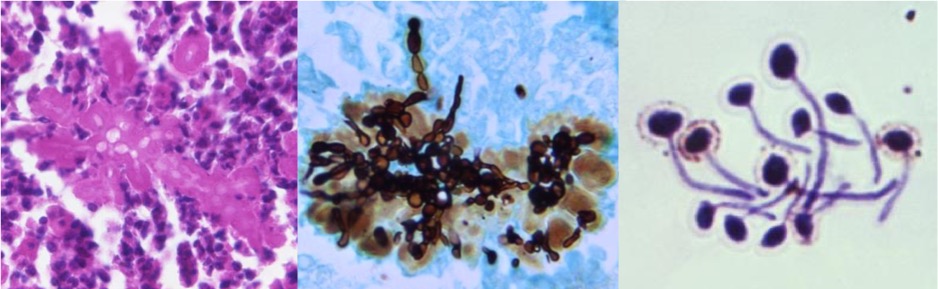 <p><em>Candida albicans</em> Histology
