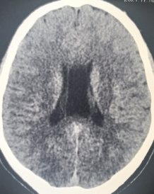 <p>Cavum Vergae