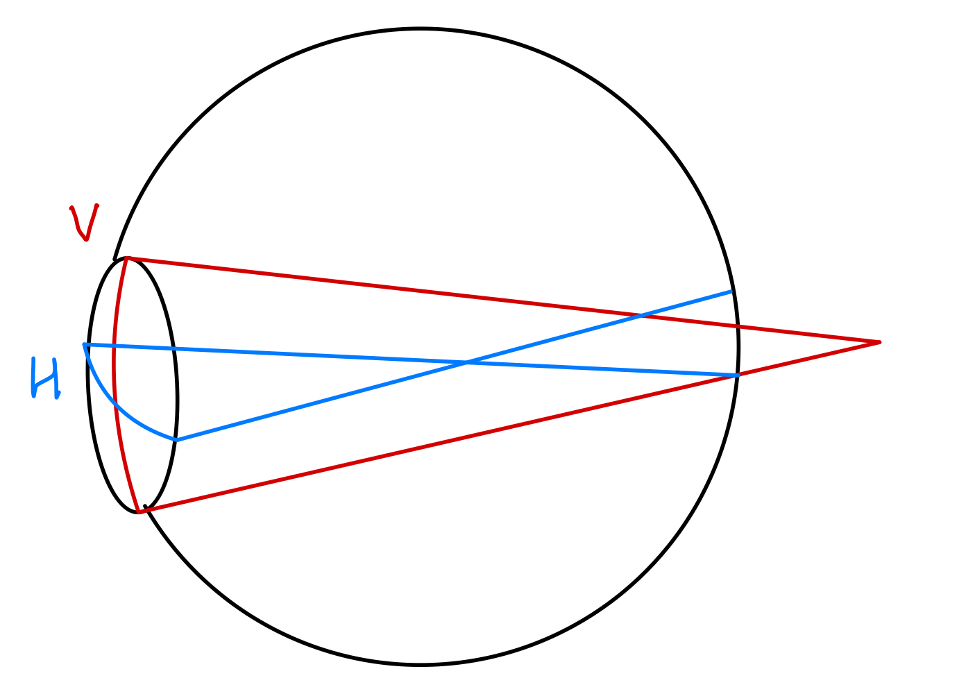 <p>Refractive Profile of Mixed Astigmatism