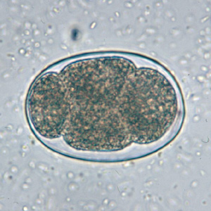 <p>Hookworm Eggs