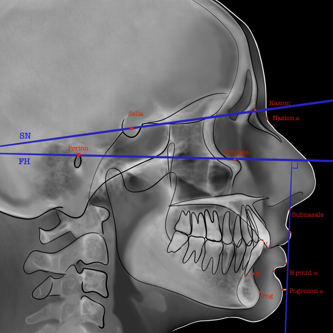 <p>True Vertical Line