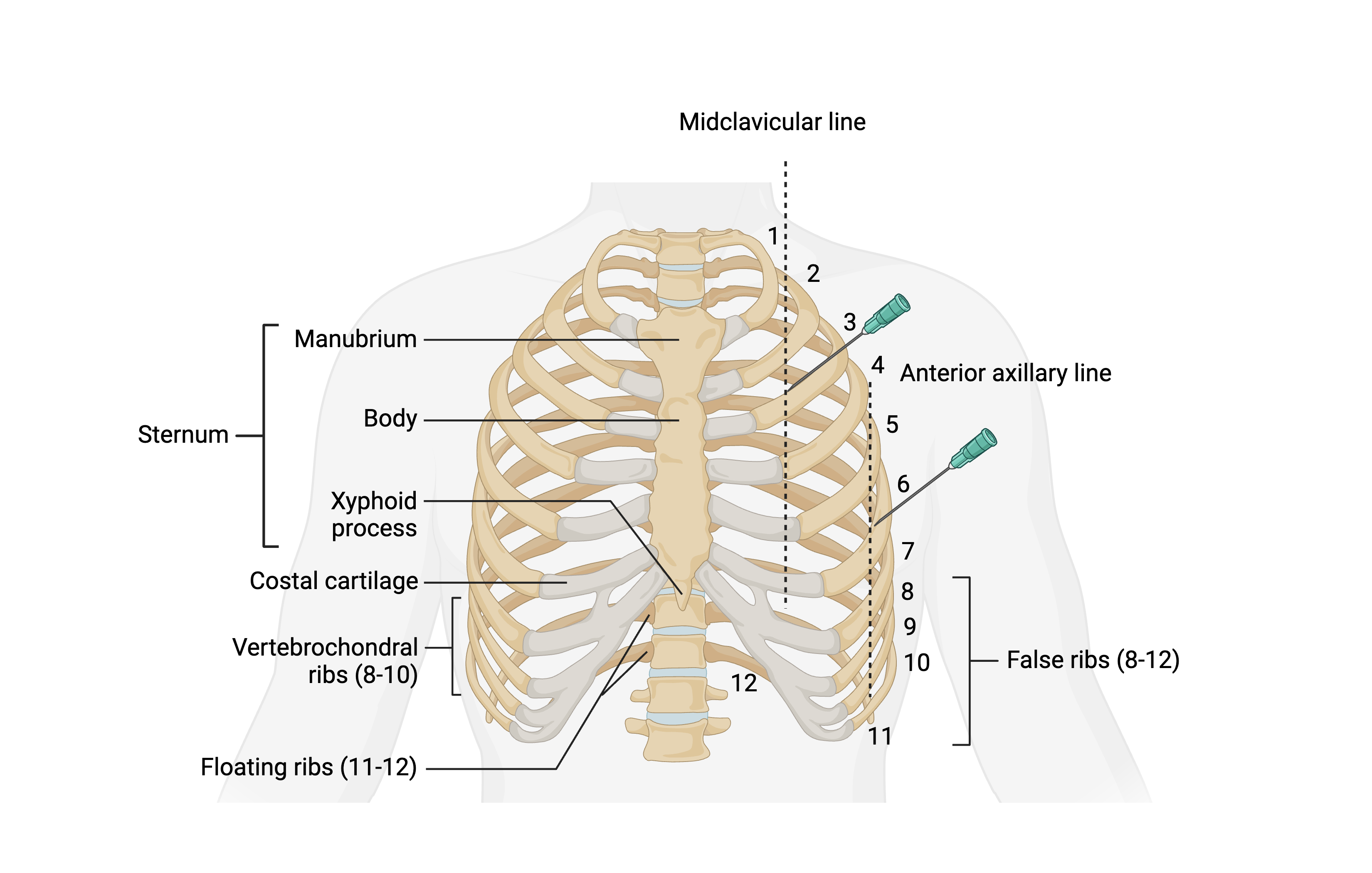 <p>Emergency Needle Decompression Sites