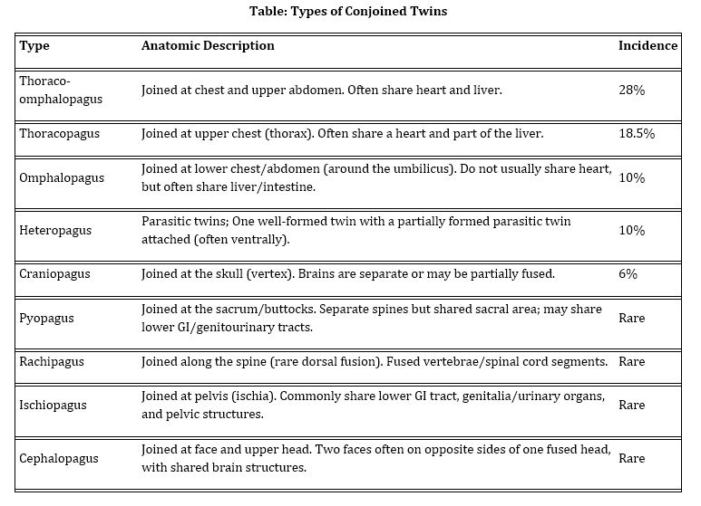 <p>Major Types of Conjoined Twins</p>