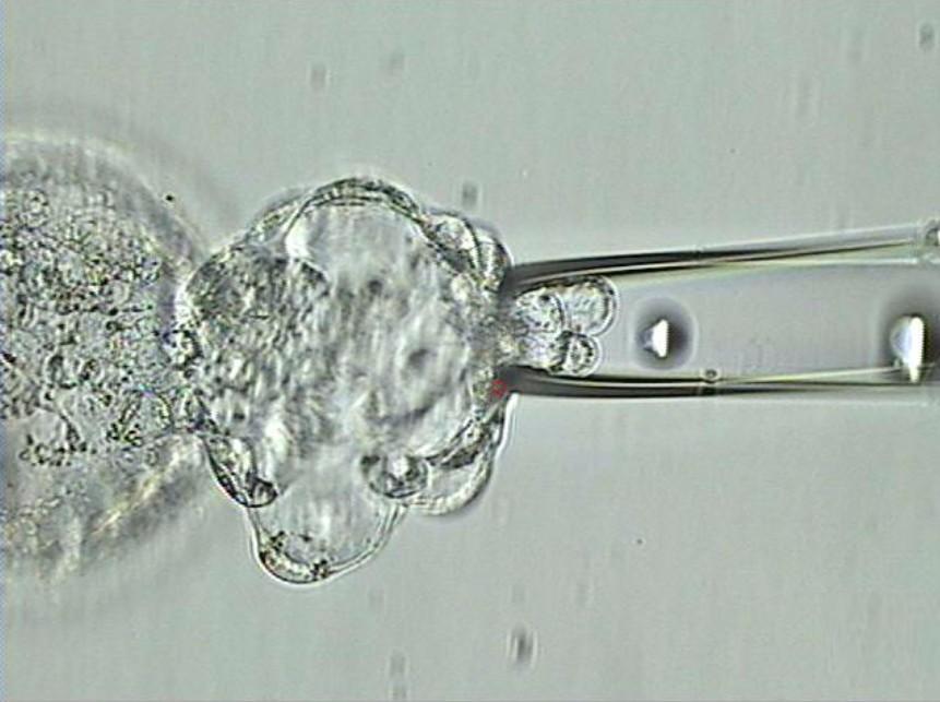 <p>Trophectoderm Biopsy at the Blastocyst Stage