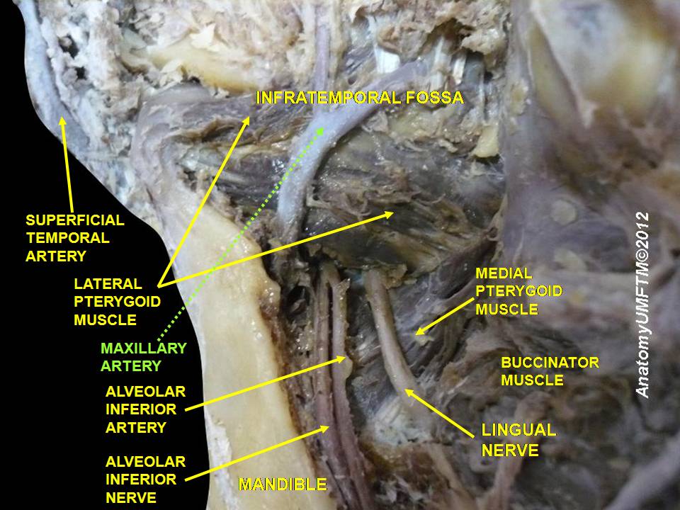 <p>Dissection of the Maxillary Artery in the Head and Neck