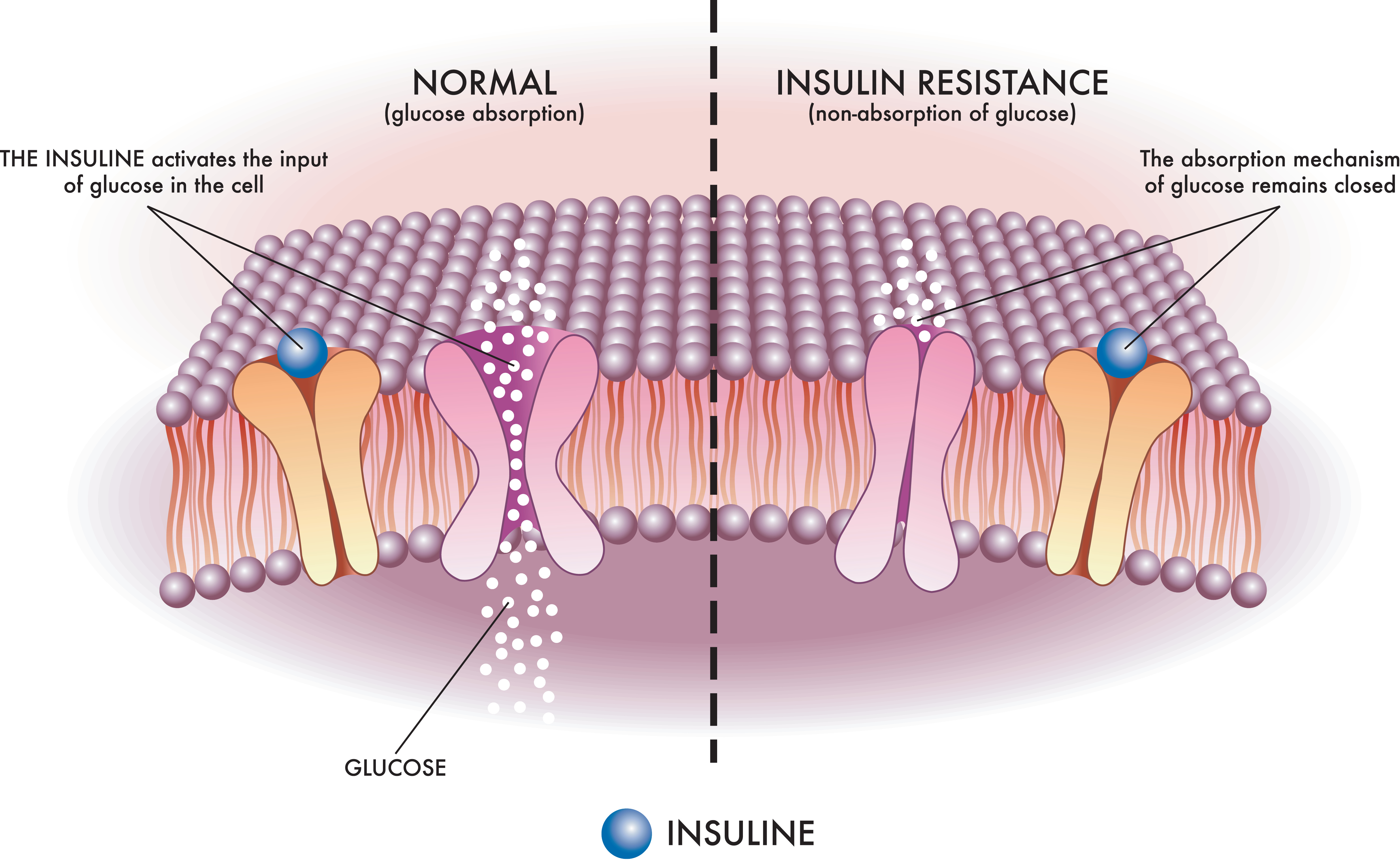 <p>Insulin Resistance Mechanism
