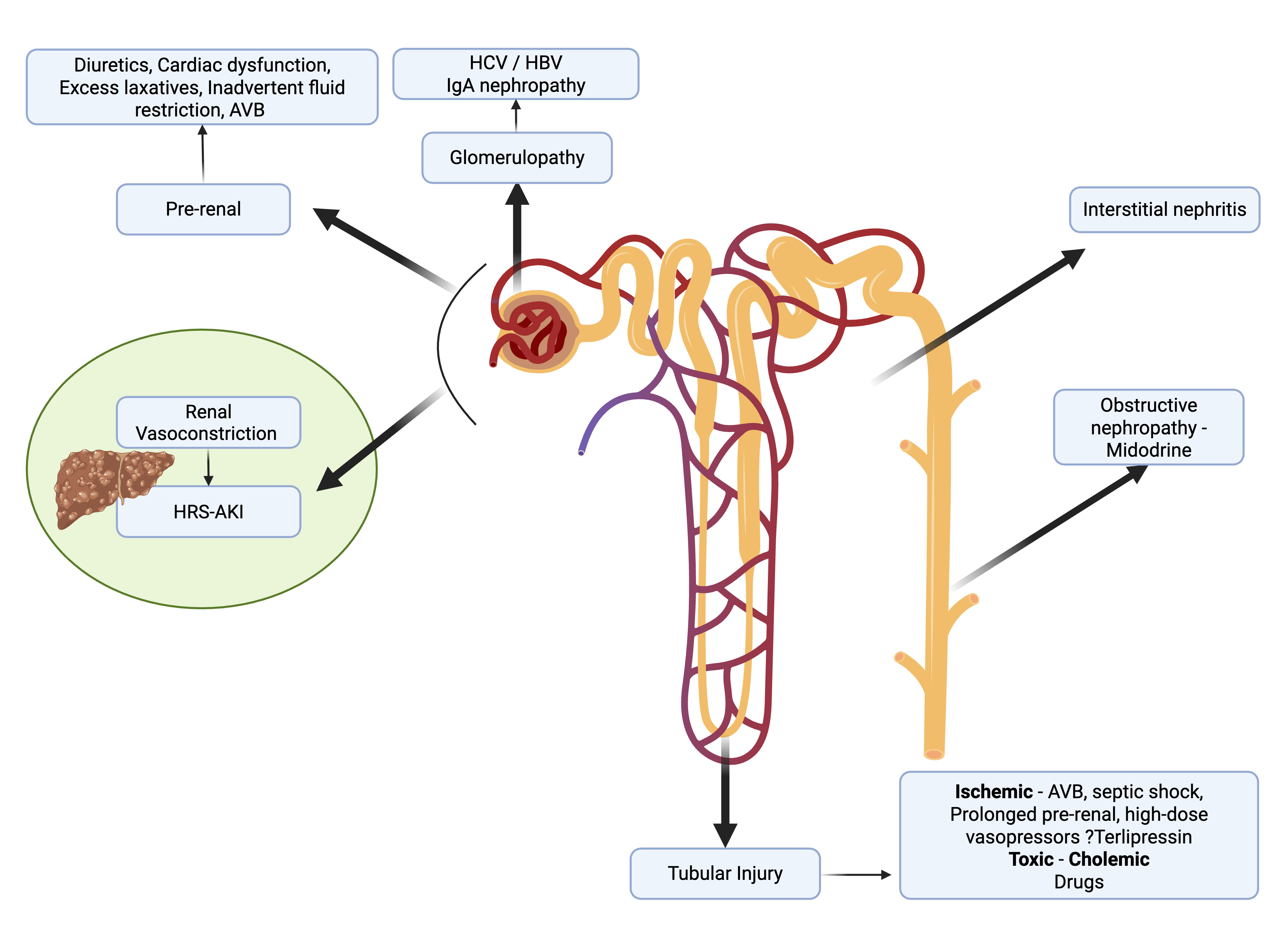 <p>Acute Kidney Injury. Differential diagnosis of acute kidney injury in a patient with cirrhosis of the liver.</p>