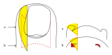 <p>Wedge Excisions