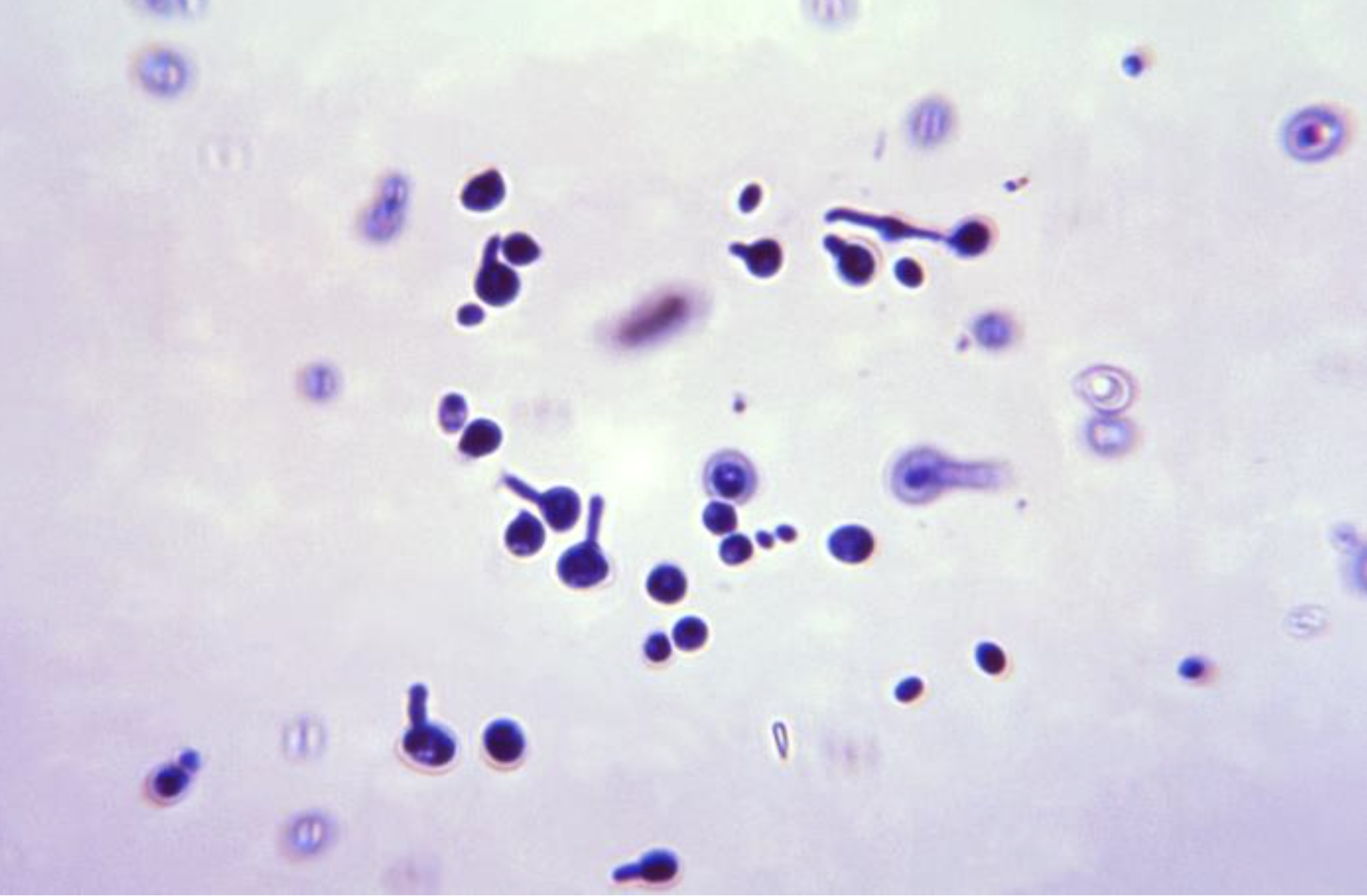 <p><em>Candida Albicans</em> Yeast Form With Germ Tube