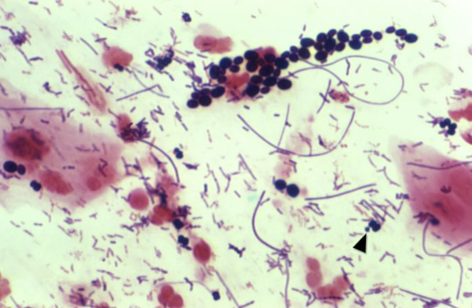 <p>Gram Stain of <em>Candida.&nbsp;</em>Gram stain of various forms of <em>Candida.</em></p>