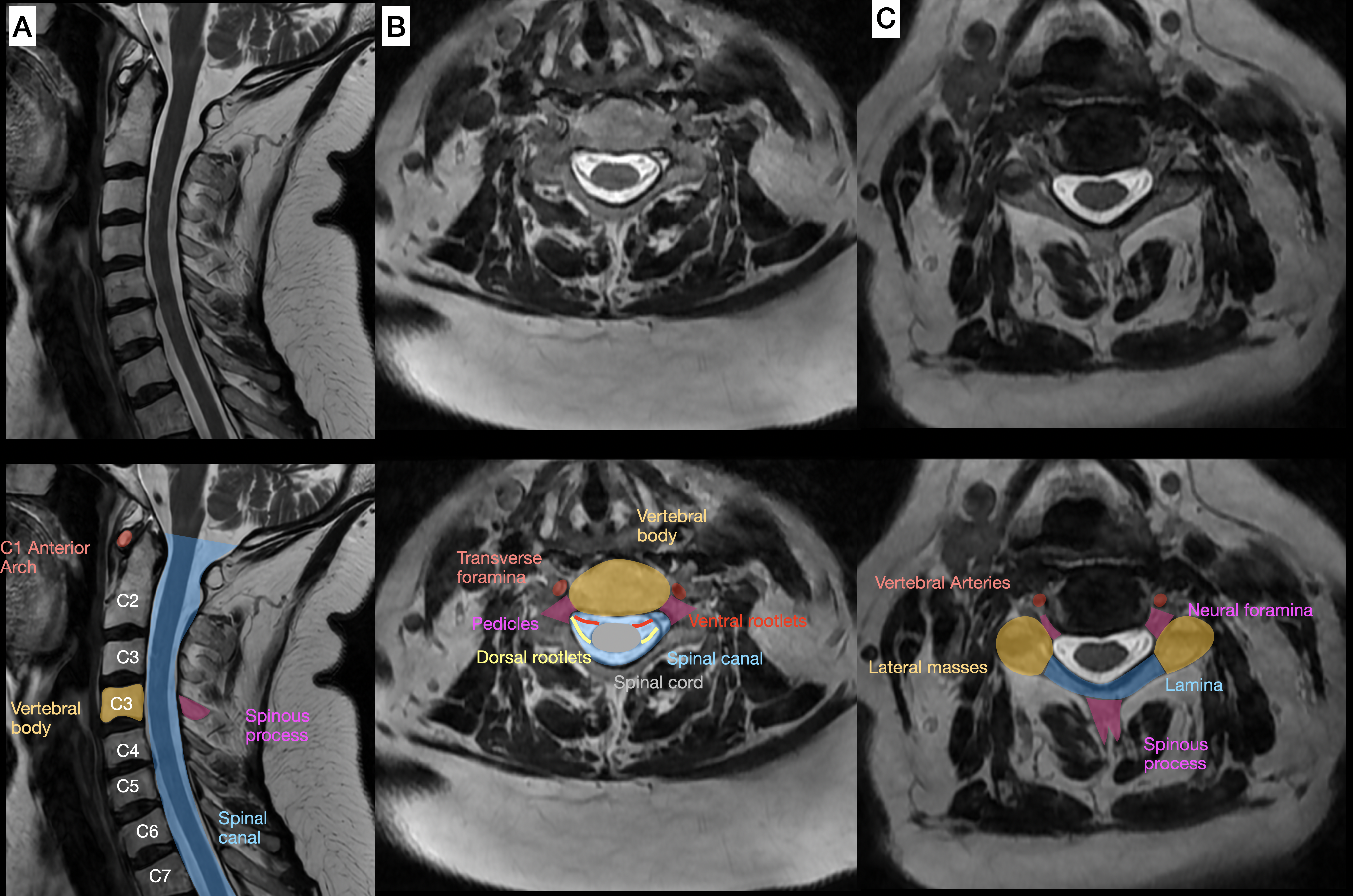<p>Cervical Spine Magnetic Resonance Imaging&nbsp;in Multiple Views