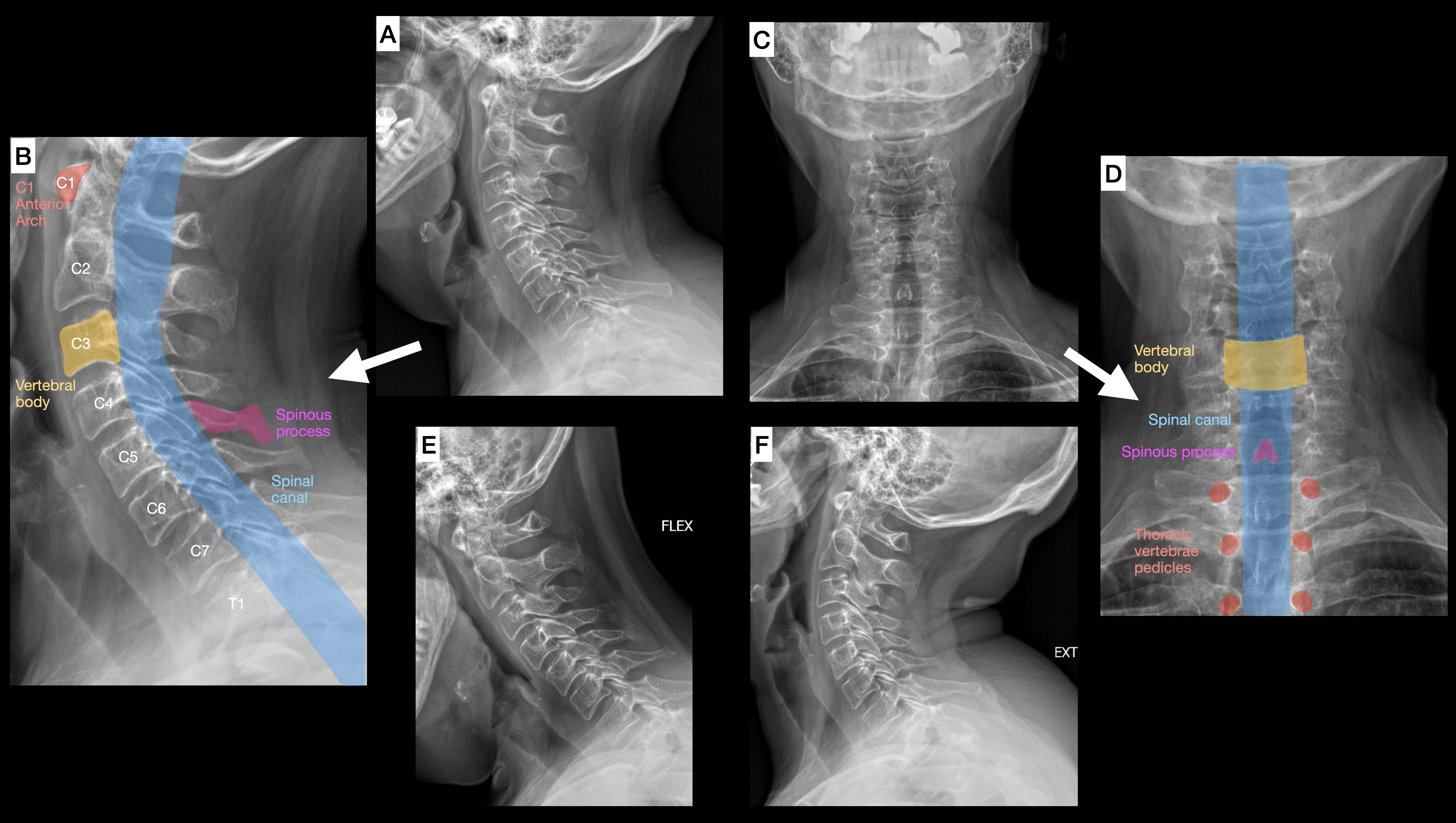 <p>Cervical Spine Radiographic Anatomy and Motion