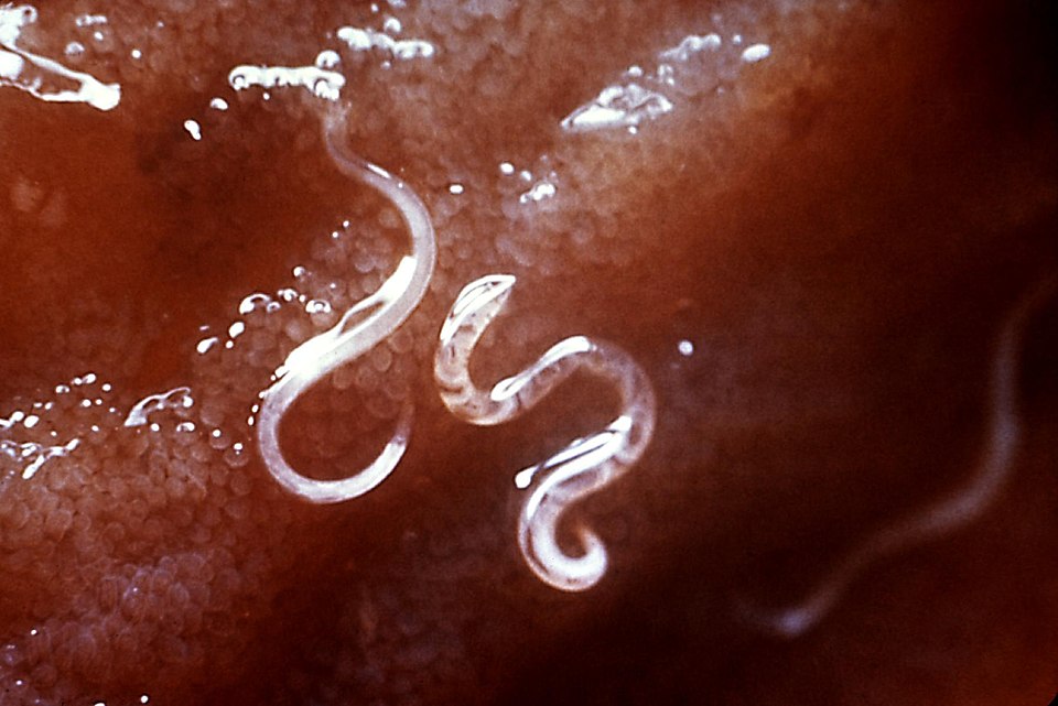 <p>Hookworm Histopathology