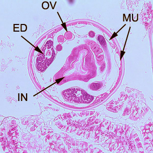 <p>Hematoxylin and eosin (H&amp;E)-stained histopathology of a transverse section through an adult hookworm (<em>Ancylostoma duodenale</em> or <em>Necator americanus</em>) embedded in duodenal mucosa