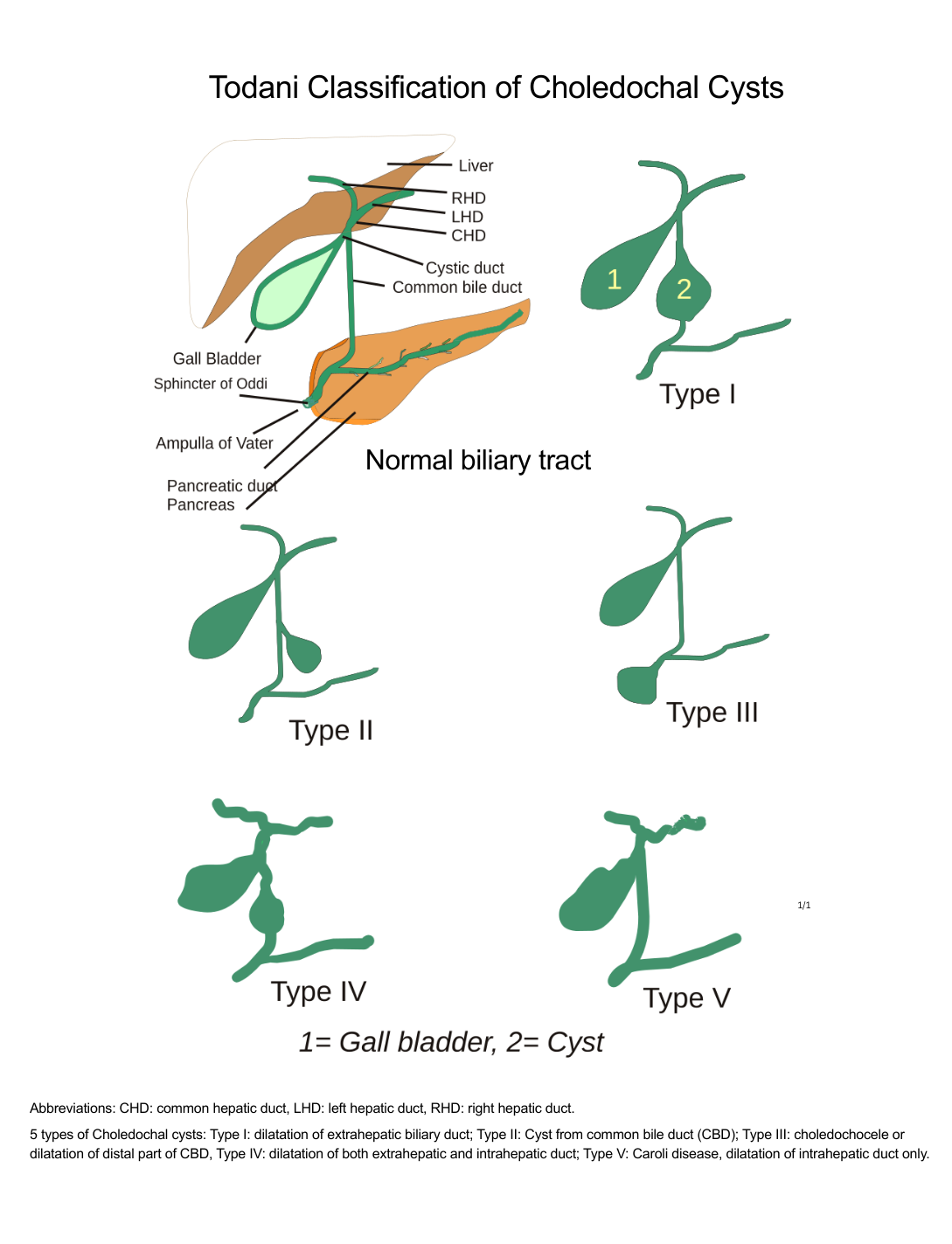 <p>Todani Classification of Choledochal Cysts