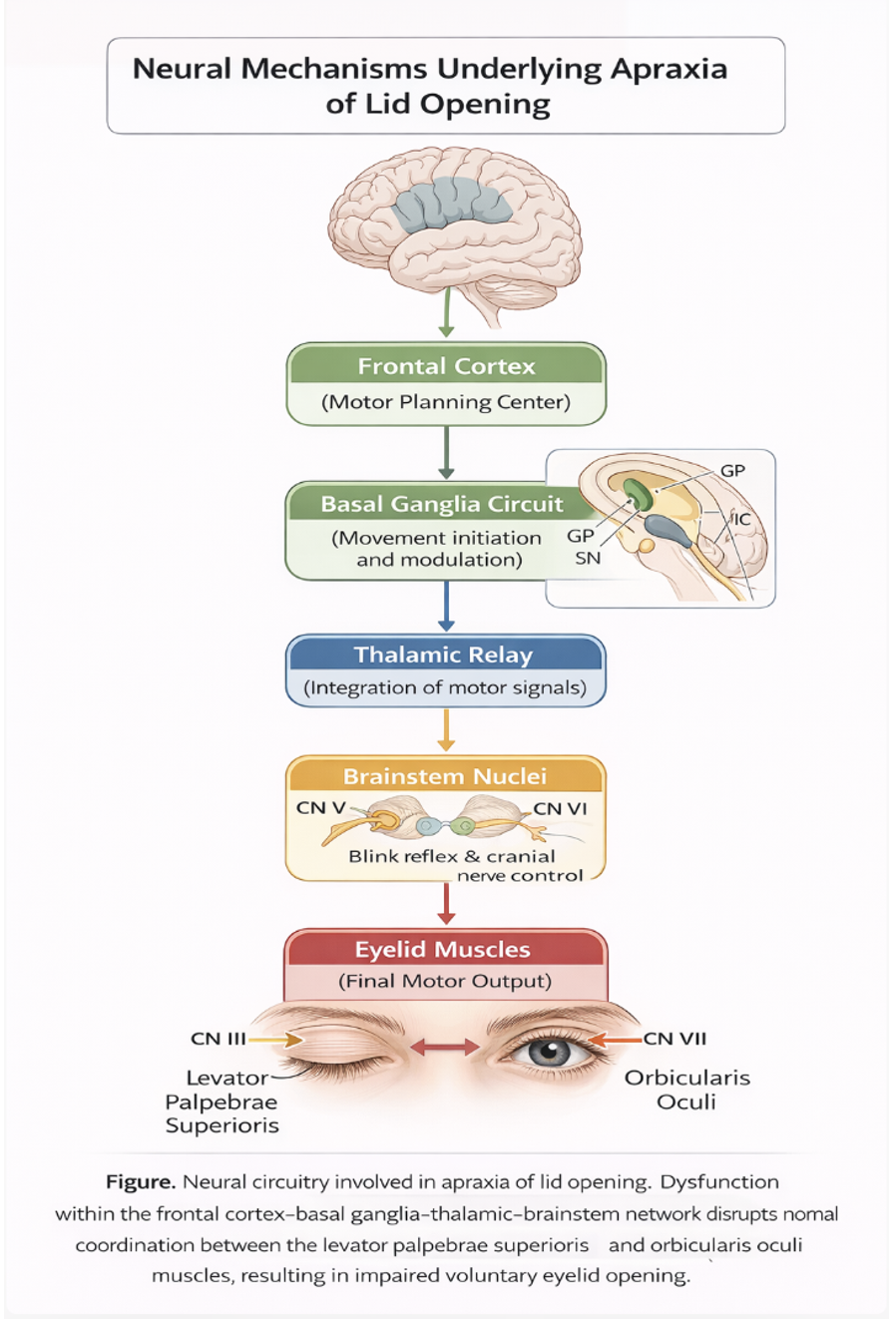 <p>Neural Mechanisms of Apraxia of Lid Opening