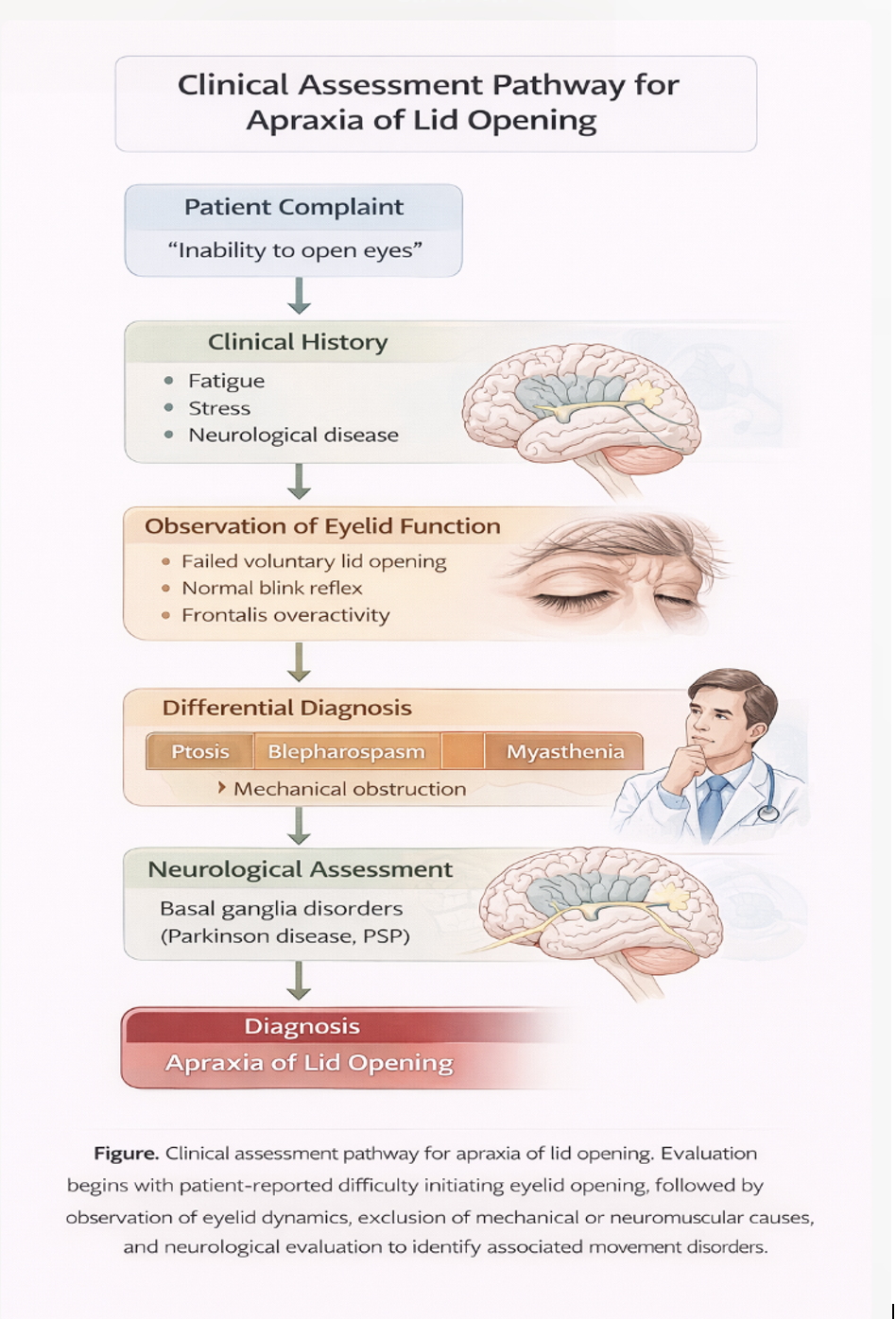 <p>Clinical Assessment Pathway for Apraxia of Lid Opening