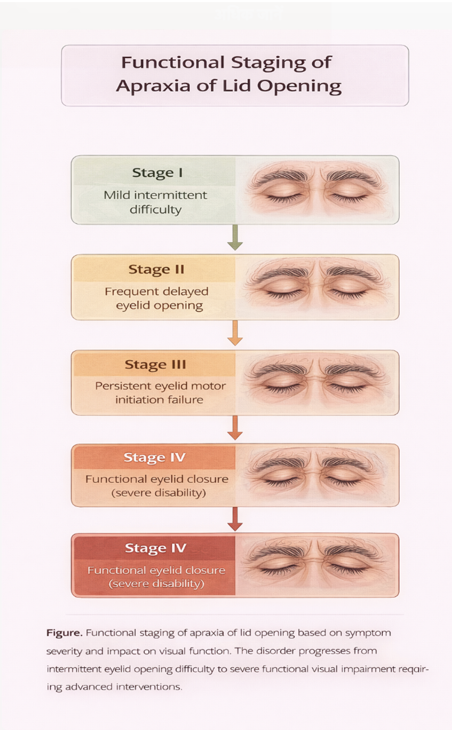 <p>Functional Staging of Apraxia of Lid Opening