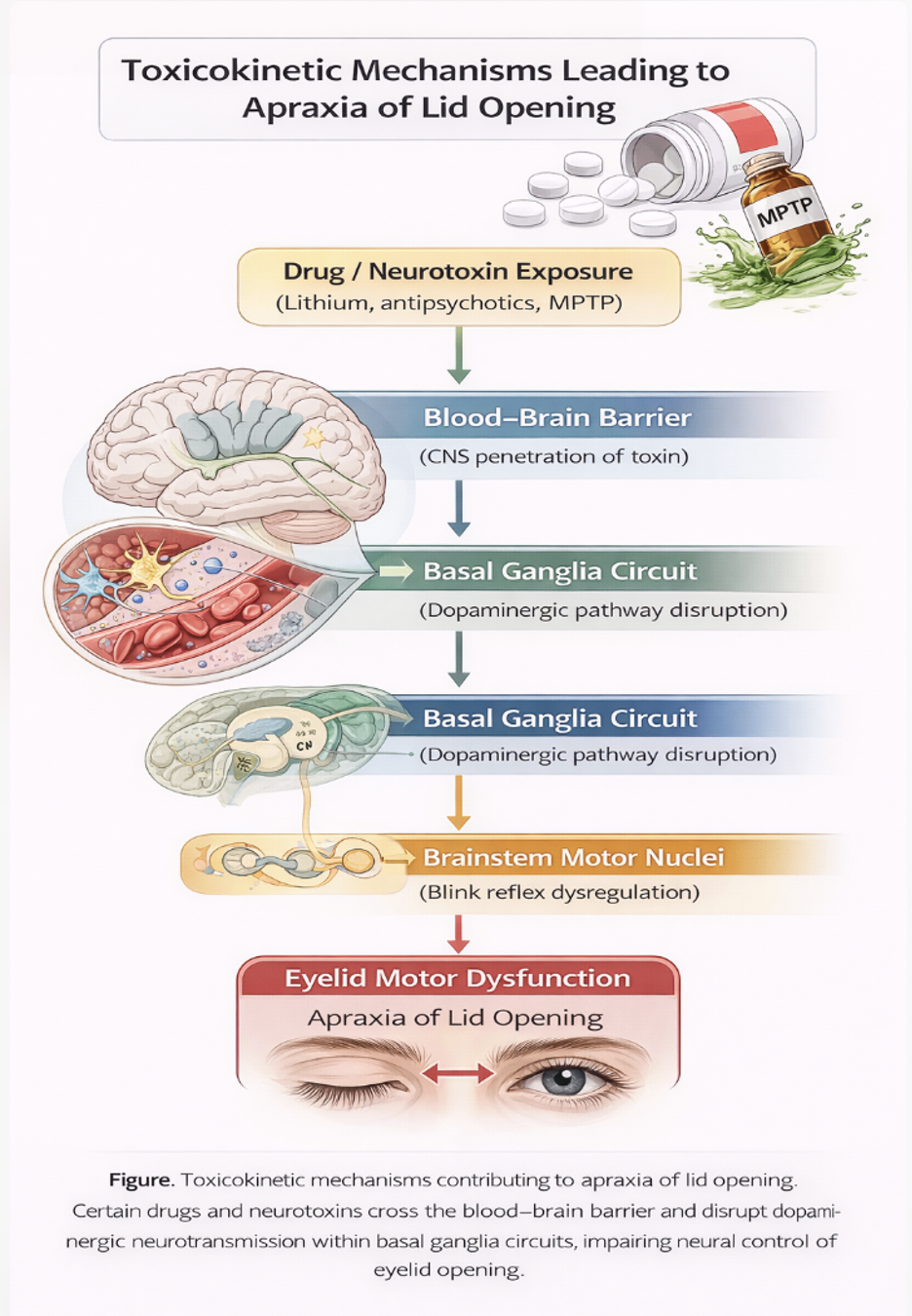 <p>Toxicokinetic Mechanisms in Apraxia of Lid Opening