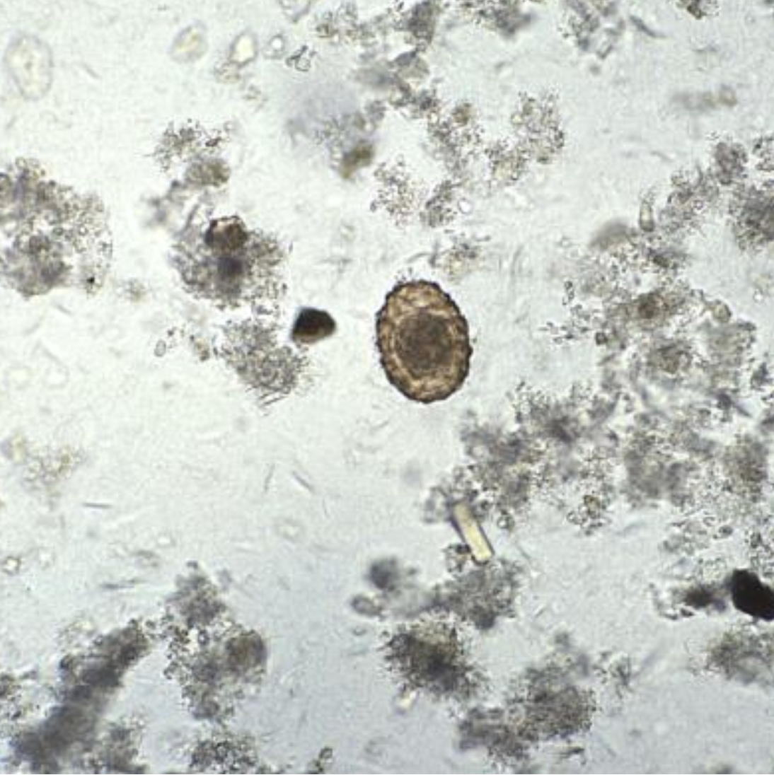 <p><em>Ascaris</em> Ova